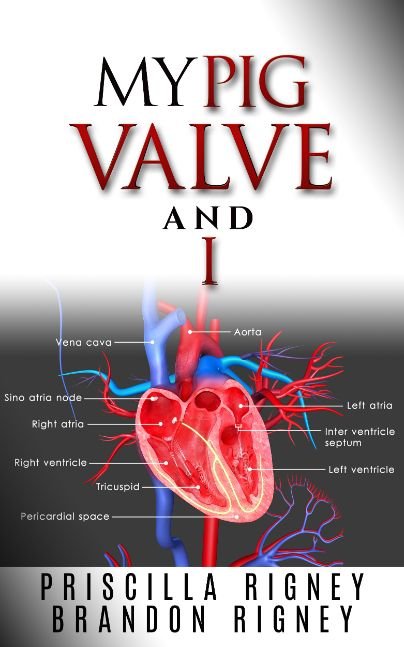 My Pig Valve and I